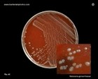 Neisseria gonorrhoeae photos